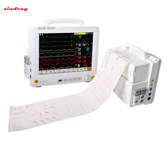 Portable Cardiac Monitor