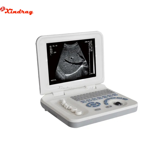 Portable Laptop Ultrasound Scanner 