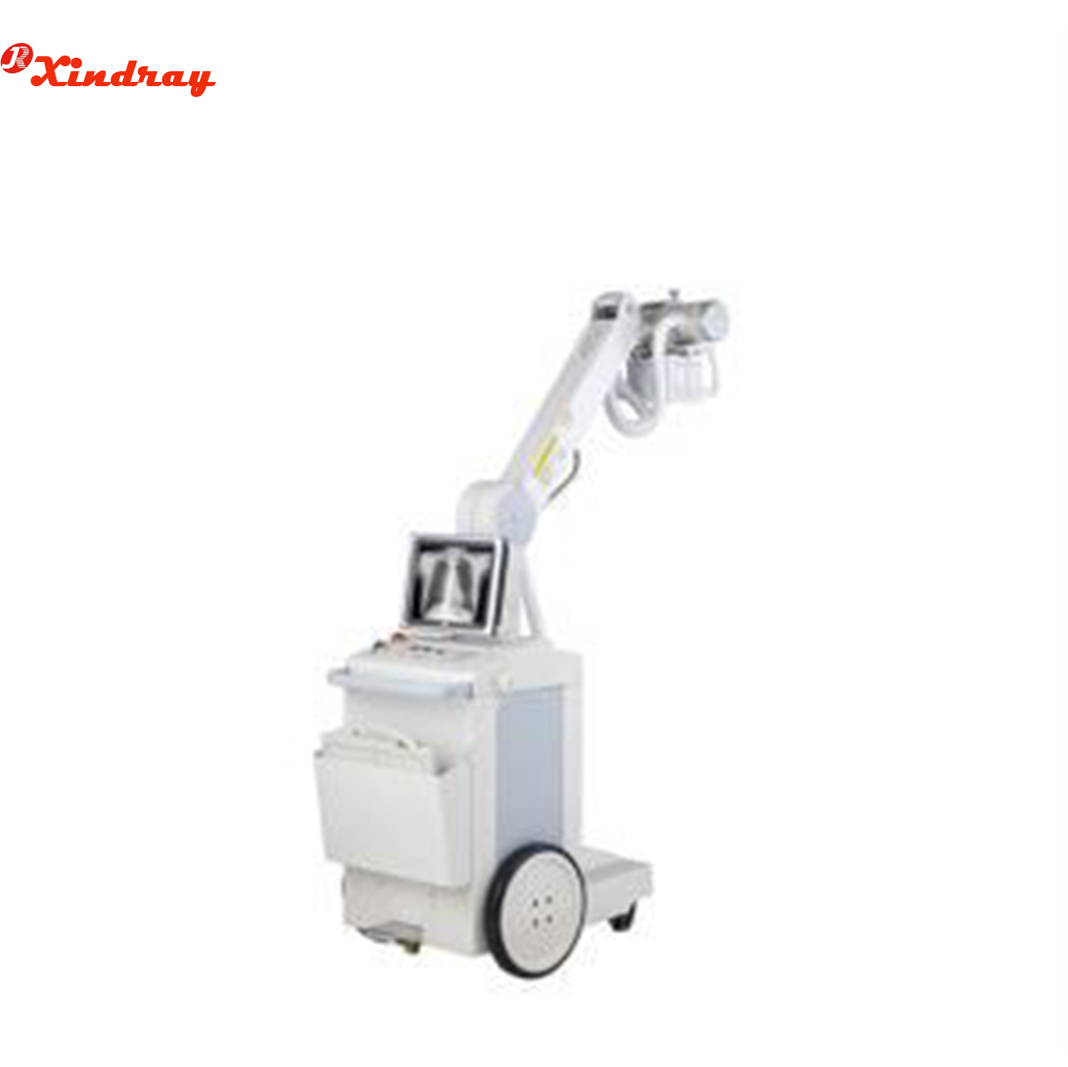 Mobile High Frequency Digital X-Ray Radiography System