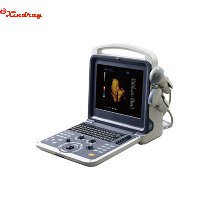 Full Digital Color Doppler Ultrasonic Diagnostic System