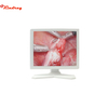 Monitor for Endoscope 