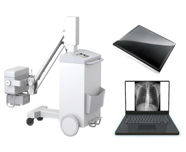 Digital Mobile X-ray System