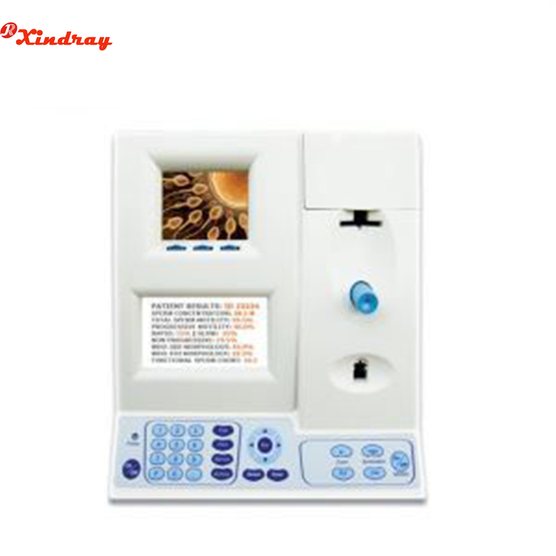 Automated Sperm Quality Analyzer