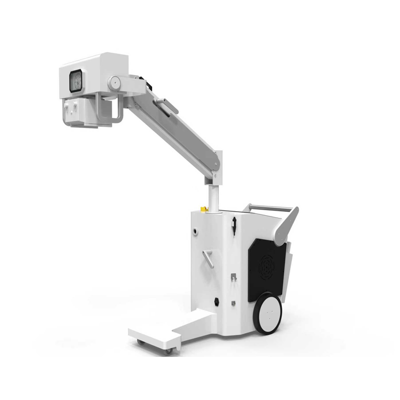 Advanced Digital Mobile X-Ray System