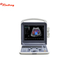 Portable Color Doppler Ultrasound Diagnostic System