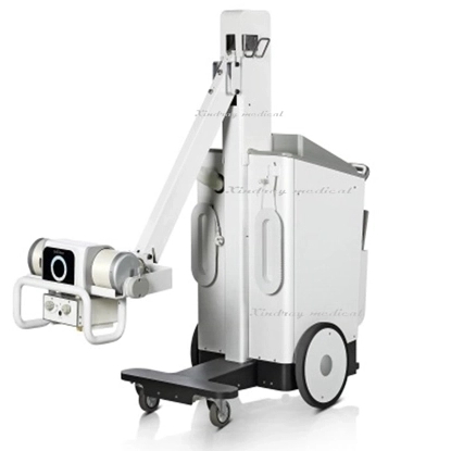 Digital Mobile X-ray Machine