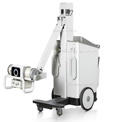 Digital Mobile X-ray Machine