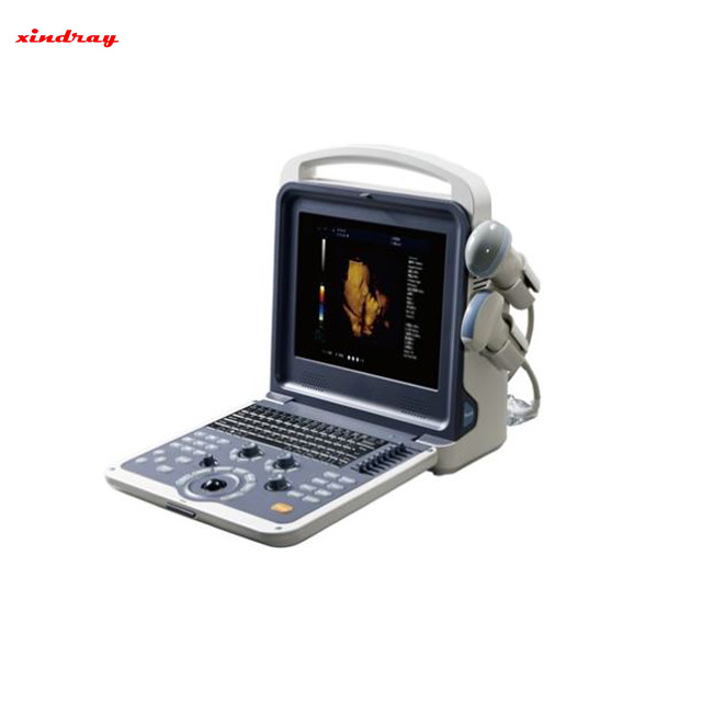 Portable Color Doppler Ultrasound