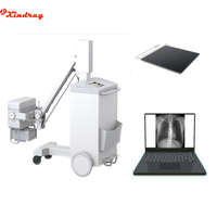 Xrx150 Digital X-ray System