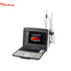 Full Digital Laptop Ultrasound Scanner