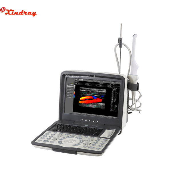 Full Digital Laptop Ultrasound Scanner