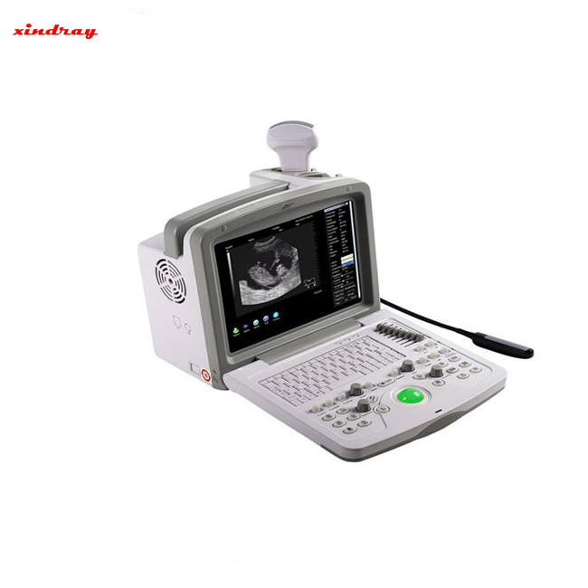 B-Ultrasound Diagnostic System